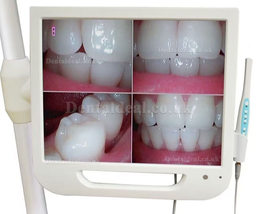 Dental Intraoral Camera 17 Inch High-Definition Digital LCD AIO Monitor